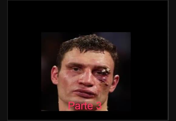 I campioni si rialzano una volta di più - parte 3